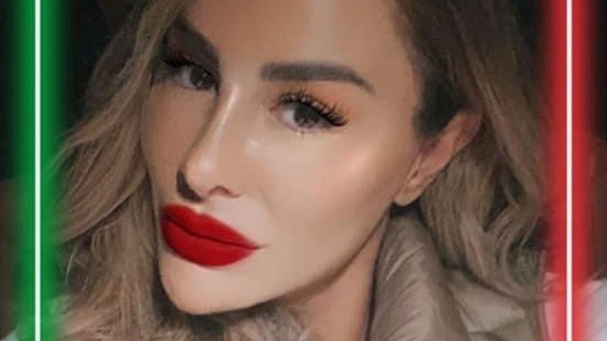 Ninel Conde y unos labios que han alborotado las redes.