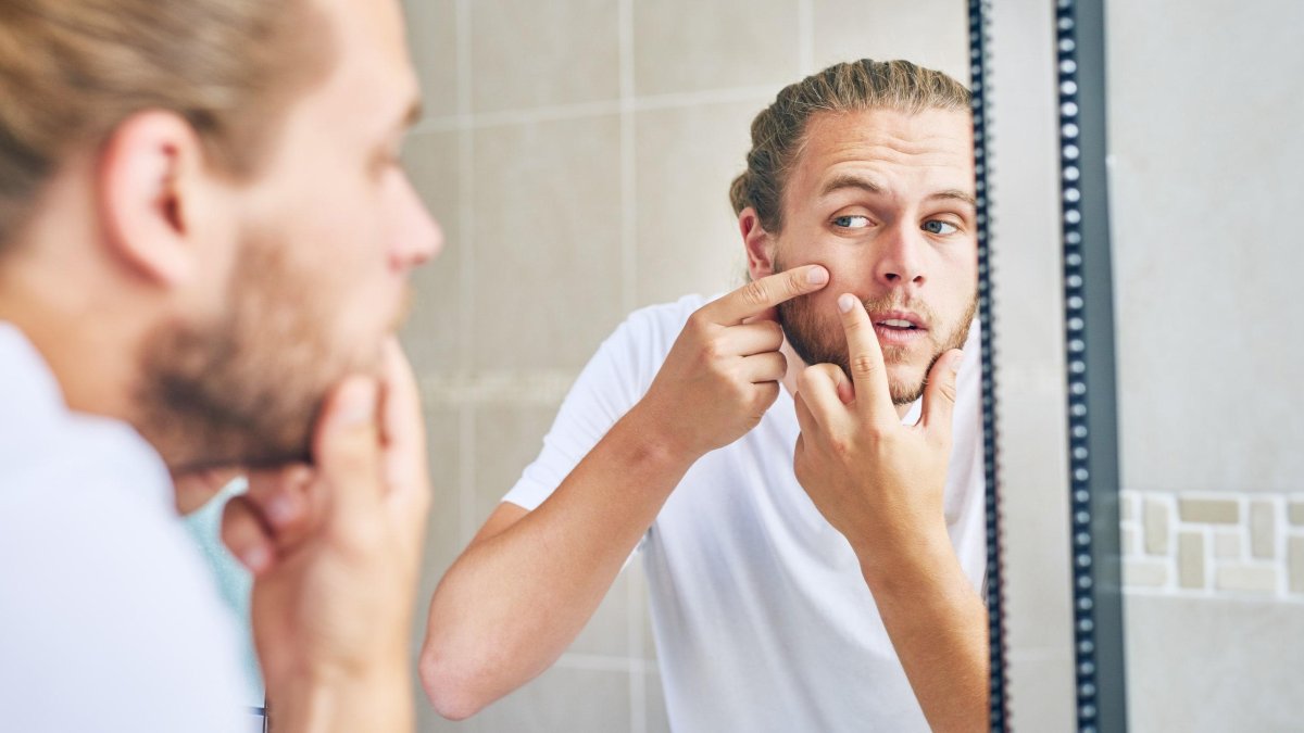 Las pieles secas o mixtas pueden desarrollar estas lesiones.