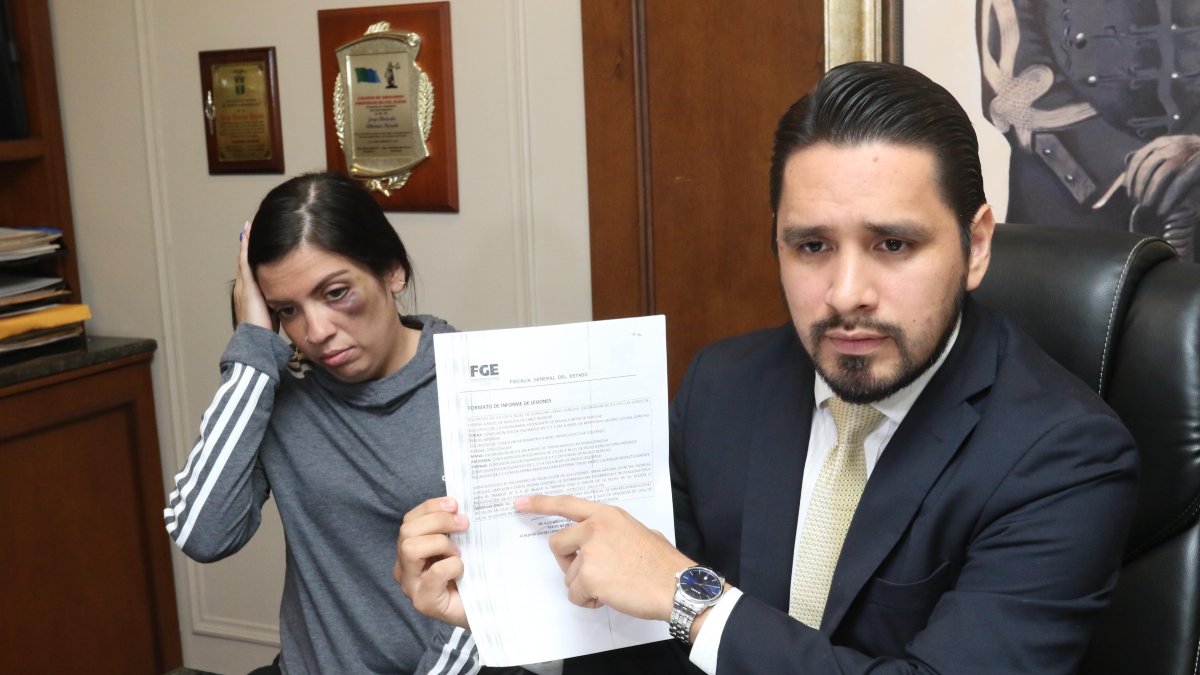 Examen. Nicolle denunció su caso ayer ante la prensa. Tras examen médico le dieron de 9 a 30 días de descanso.