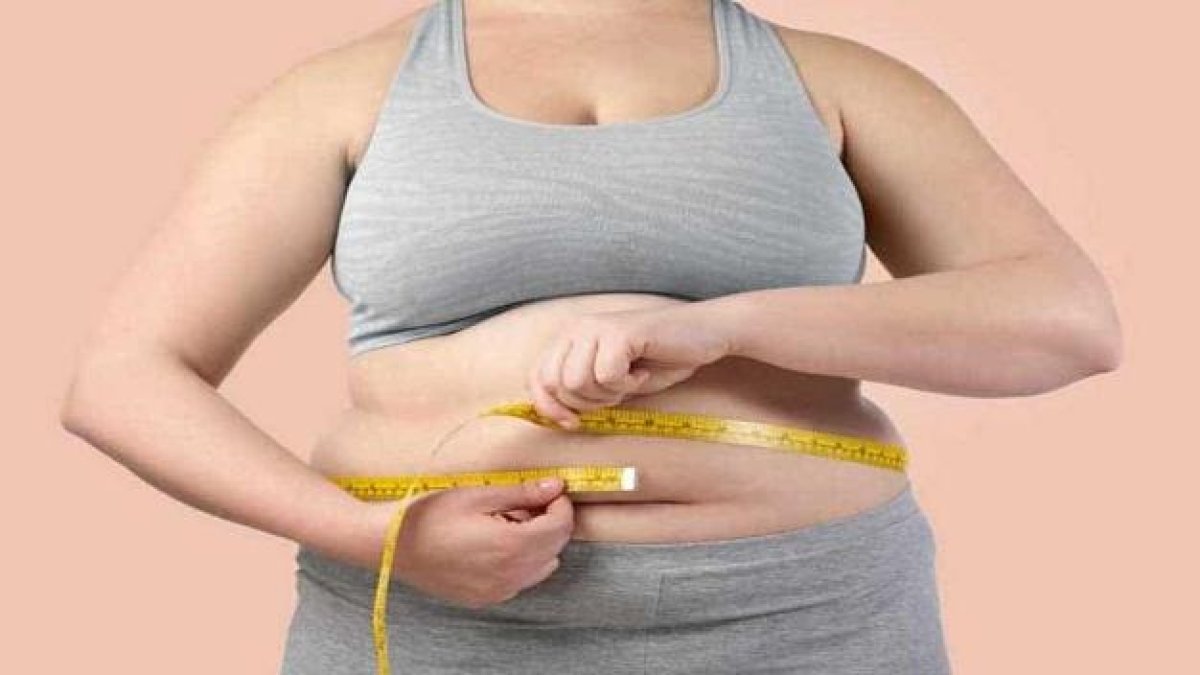 Imagen archivo mujer con obesidad