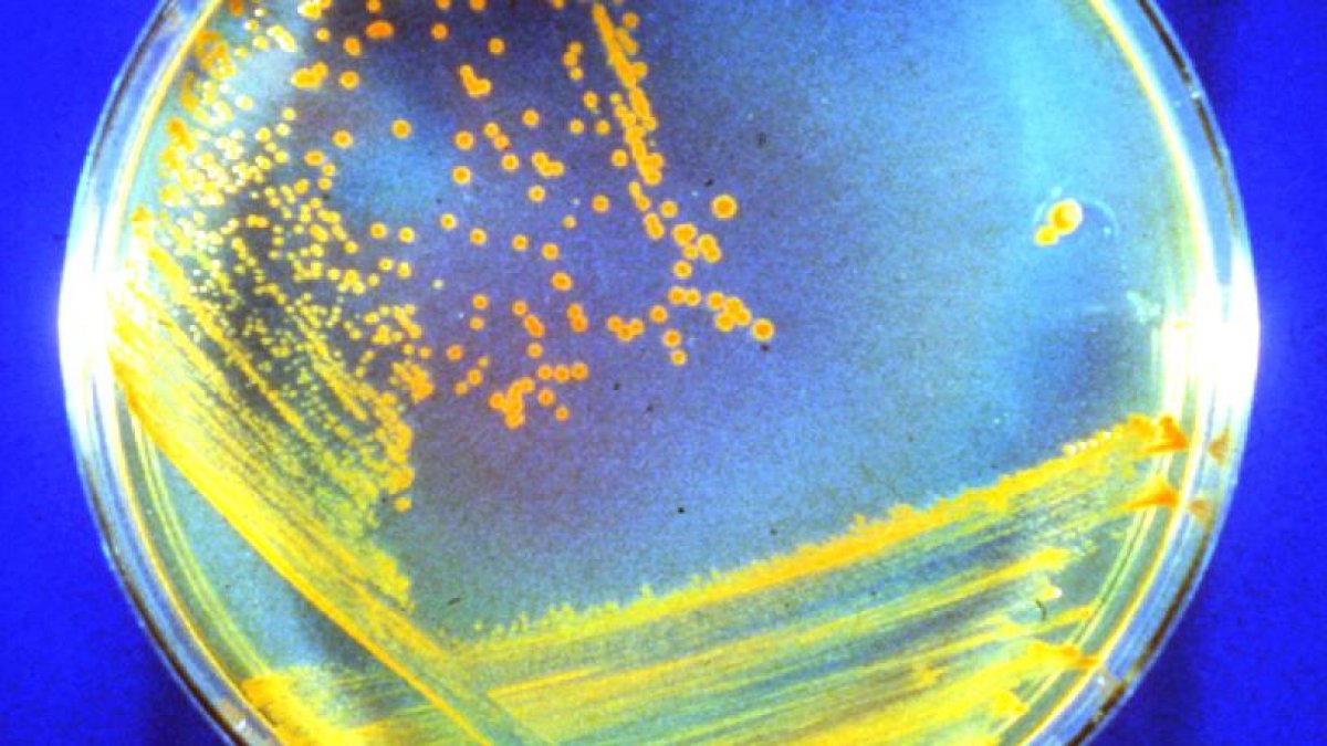 El Deinococcus radiodurans (bautizado como 