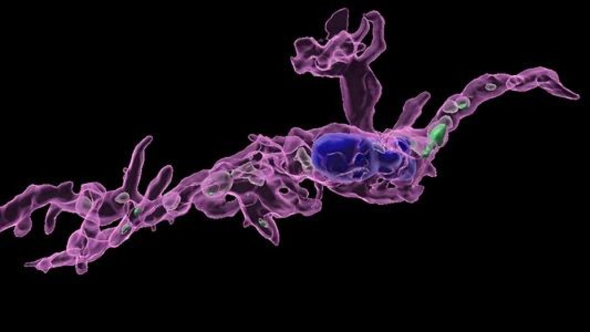 Una microglía (en magenta) de un ratón macho nacido de una madre con una dieta alta en grasas, que secuestra más serotonina cerebral (en verde) que en los machos con madres que siguen una dieta típica.
