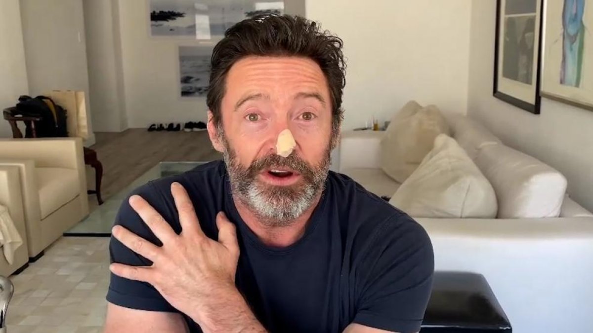 Hugh Jackman estuvo por última vez en un quirófano en 2017.