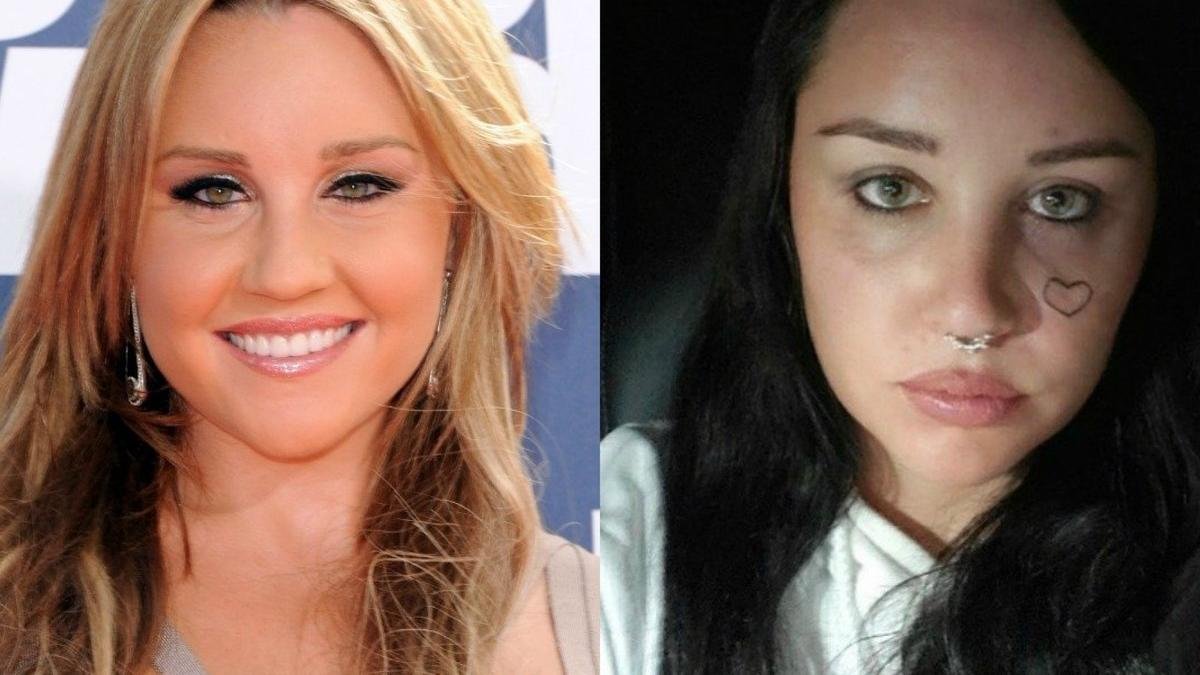 Amanda Bynes en un antes y después. Su cambio físico es notorio.