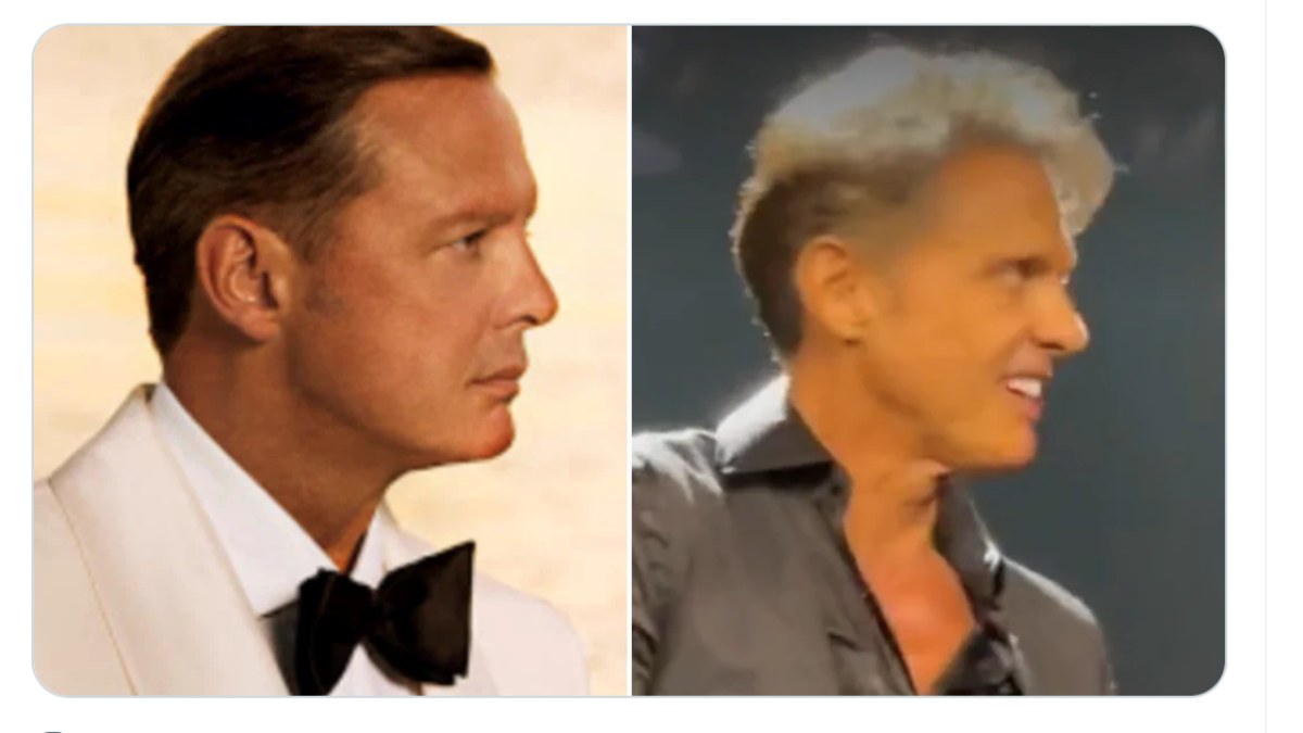 Su cambio físico es muy notorio. Muchos aseguran que se trata de un doble del artista.