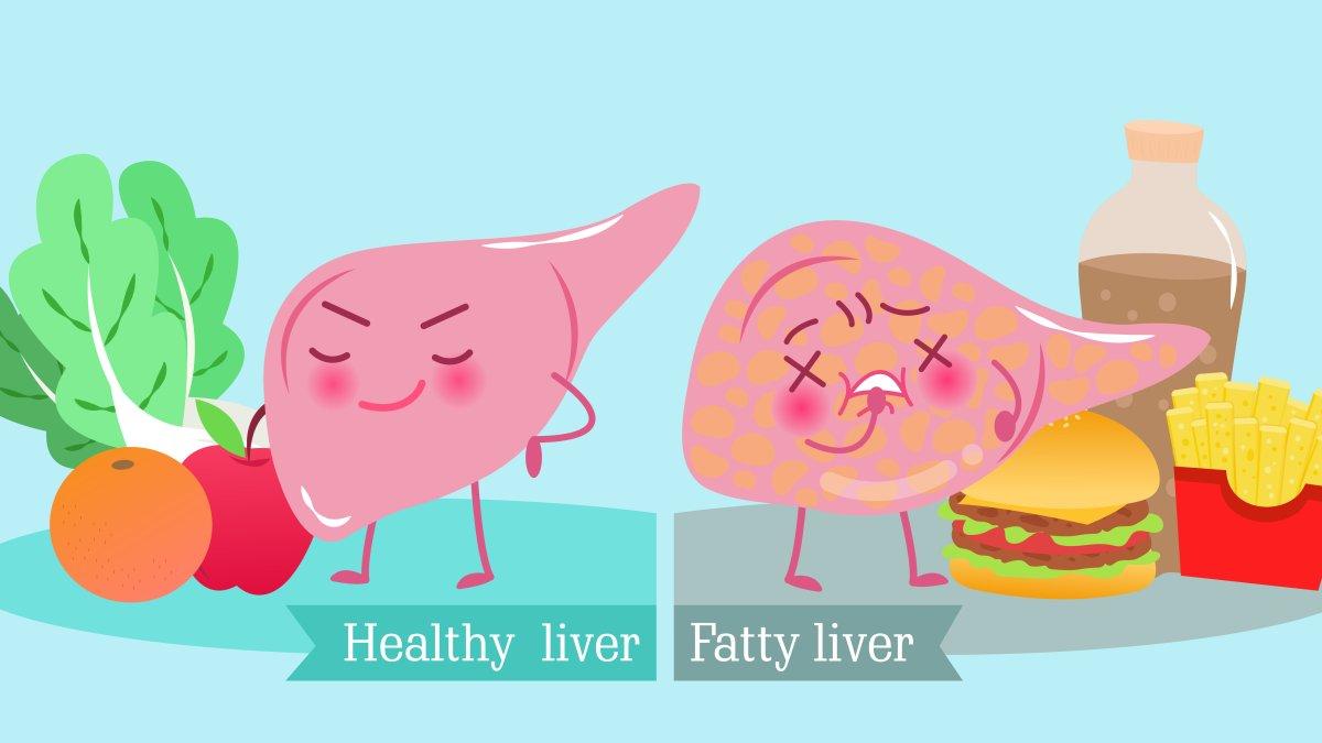 Debido a una mala alimentación, puede verse afectado por enfermedades como el colesterol alto e hígado graso.