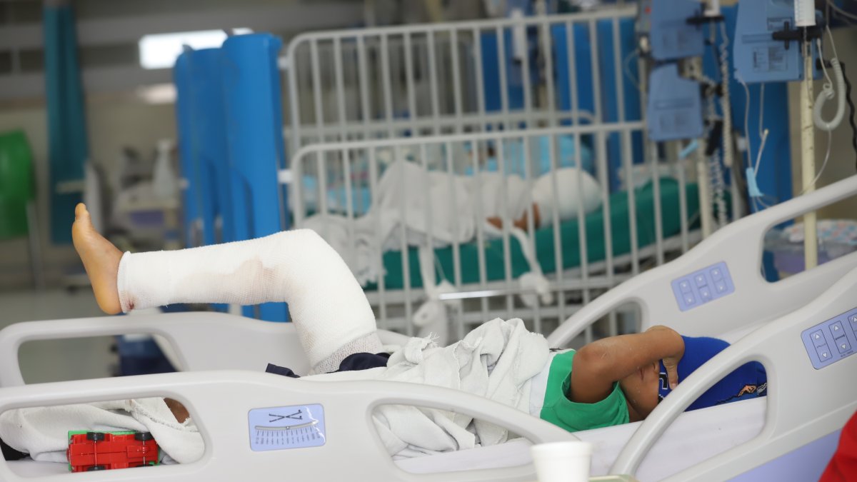 Al hospital Francisco Icaza Bustamante han ingresado 21 infantes con quemaduras.