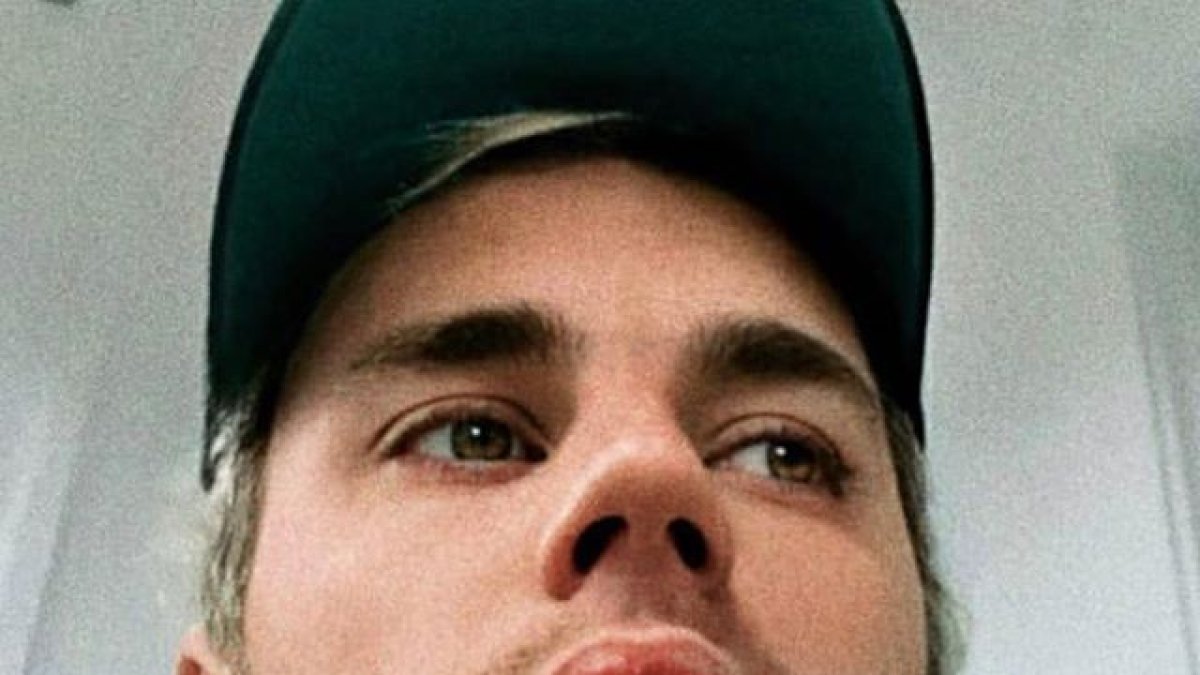 El cantante de 25 años también padece de mononucleosis.