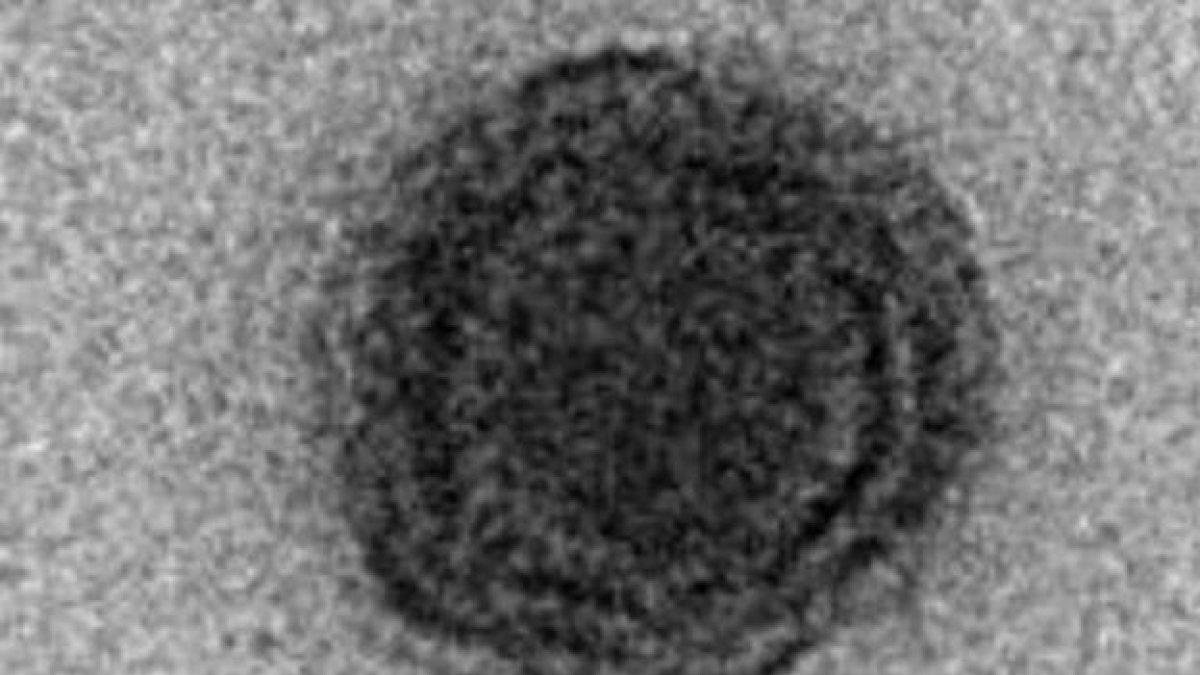 Imagen microscópica del nuevo 'Yaravirus'.