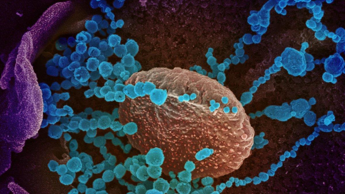 Imagen de microscopio electrónico que muestra (objetos en azul) al SARS-CoV-2, el virus que causa el brote del coronavirus COVID-19.