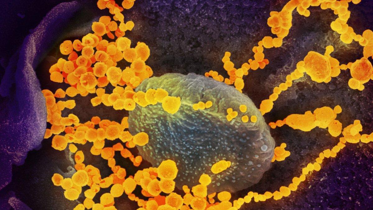 Imagen de microscopio electrónico que muestra (objetos en amarillo) al SARS-CoV-2, el virus que causa el brote del coronavirus COVID-19.