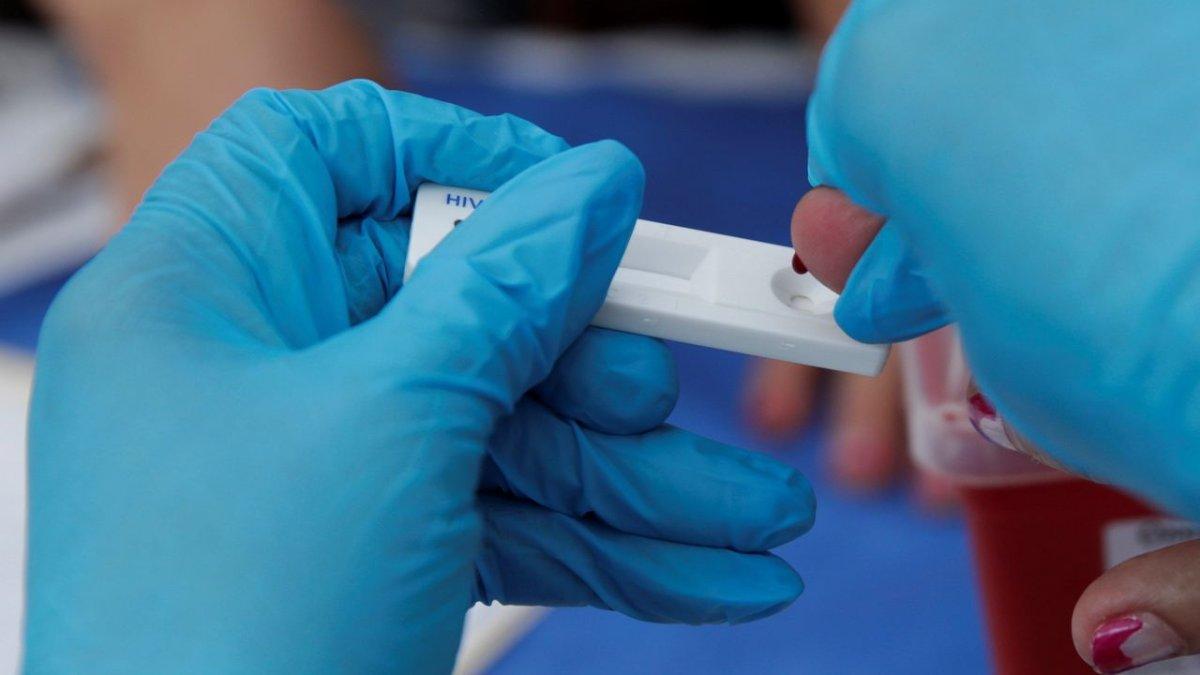 Referencial. Casi 38 millones de personas viven con el VIH en el mundo, pero únicamente 62% sigue una triterapia.
