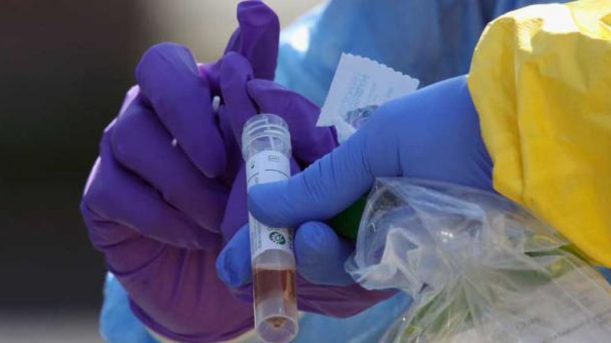 Las pruebas recomendadas para la guía terapéutica para COVID-19 son: Hemograma completo, urea, creatinina, AST/ALT, fosfatasa alcalina, LDH, proteína C reactiva cuantitativa, dímero D, interleuquina 6 (IL-6) y ferritina.