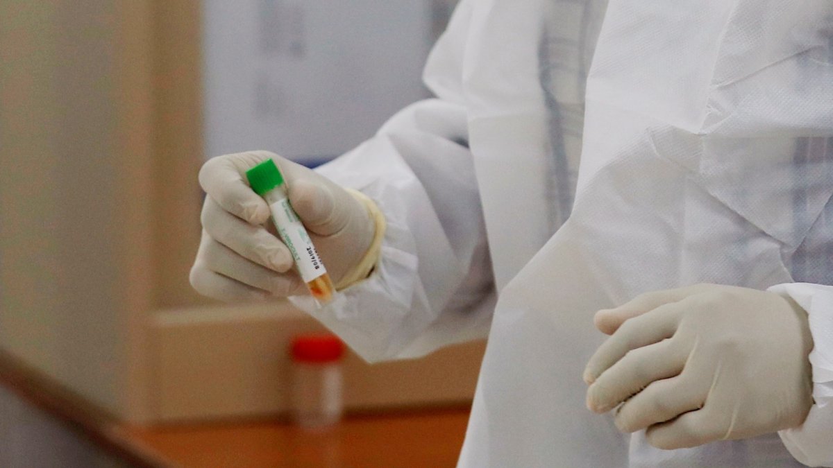 Personal médico analiza las pruebas de pacientes por posible infección por coronavirus, en el laboratorio central de salud en Sanaa, Yemen.