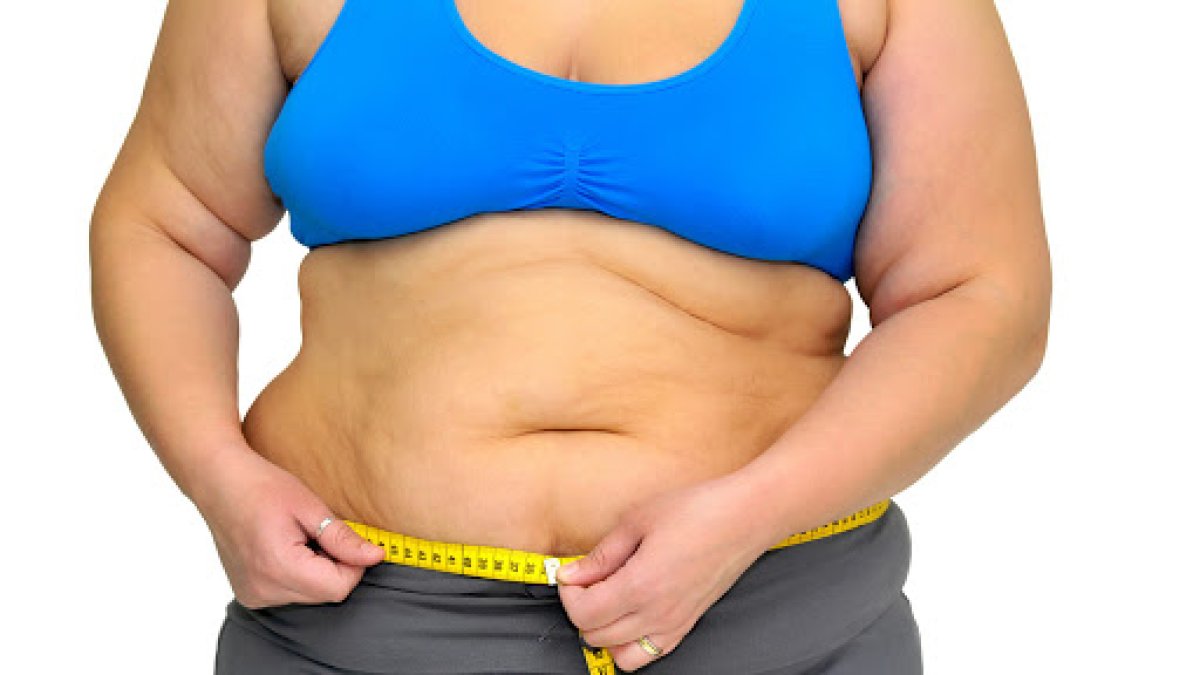 Tener exceso de peso eleva tus riesgos de sufrir obesidad tipo 2.