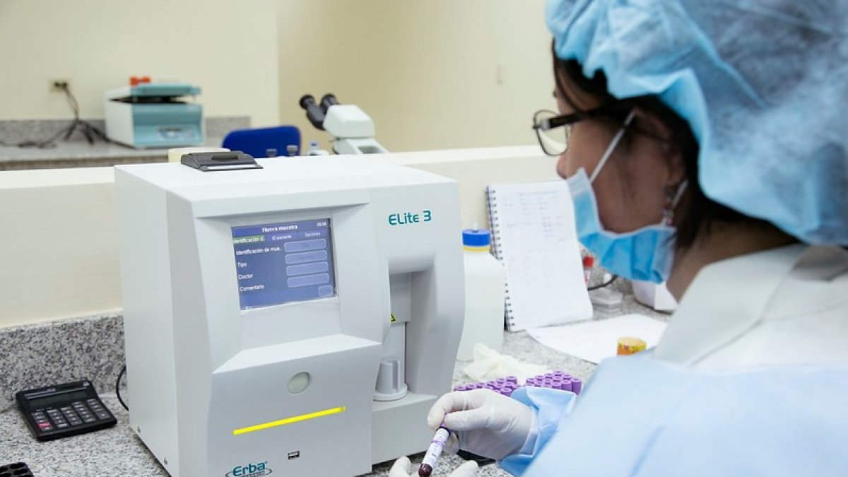 Ayer Salud señaló que se darán variaciones debido al nuevo sistema de recopilación de datos.