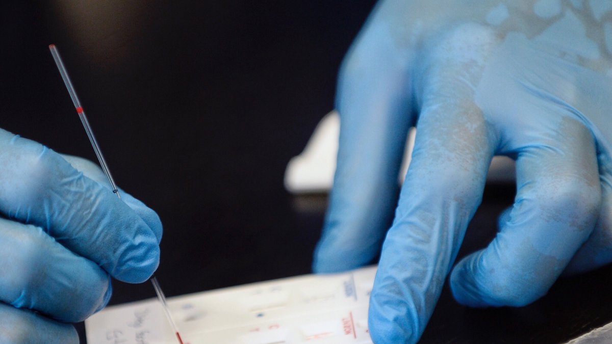 Los anticuerpos son moléculas producidas por el sistema inmunológico para combatir las infecciones en el organismo, ya sean víricas o bacteriológicas.