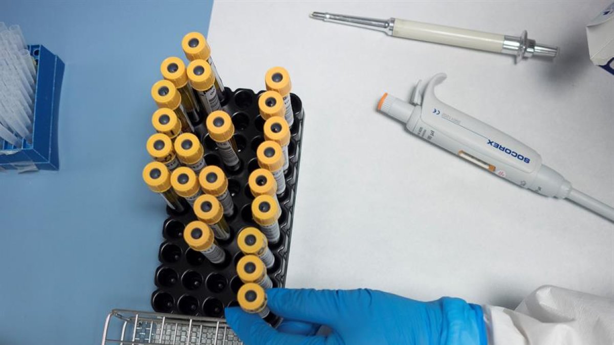 Referencial. Actualmente hay más de 100 proyectos científicos que buscan la vacuna contra el nuevo coronavirus o SARS-CoV-2, causante del COVID-19.