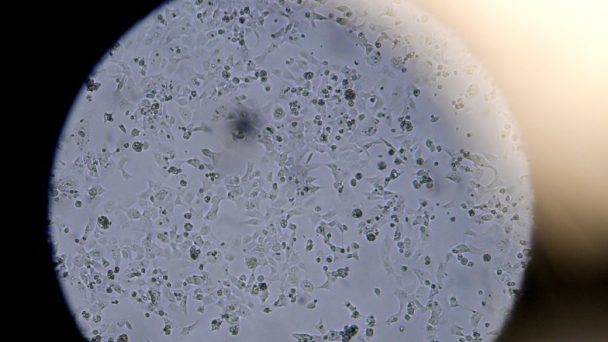 Células infectadas por el nuevo coronavirus, vistas a través de un microscopio en el laboratorio Stabilitech.