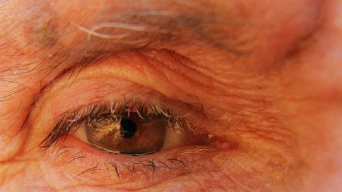 Referencial. El escáner ocular puede decodificar las proteínas de la lente humana que acumulan cambios relacionados con el envejecimiento a lo largo de la vida.