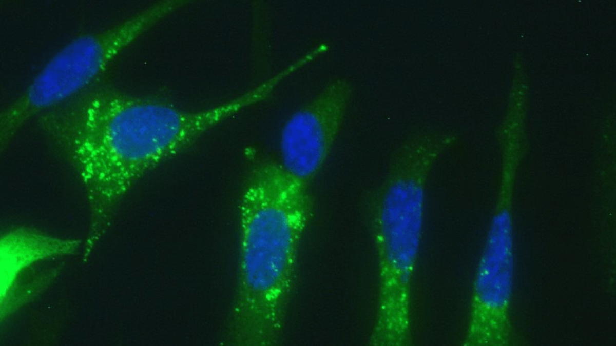 Células de adenocarcinoma pancreático mostrando activación de autofagia (puntos verdes) en respuesta al tratamiento con ABTL0812.