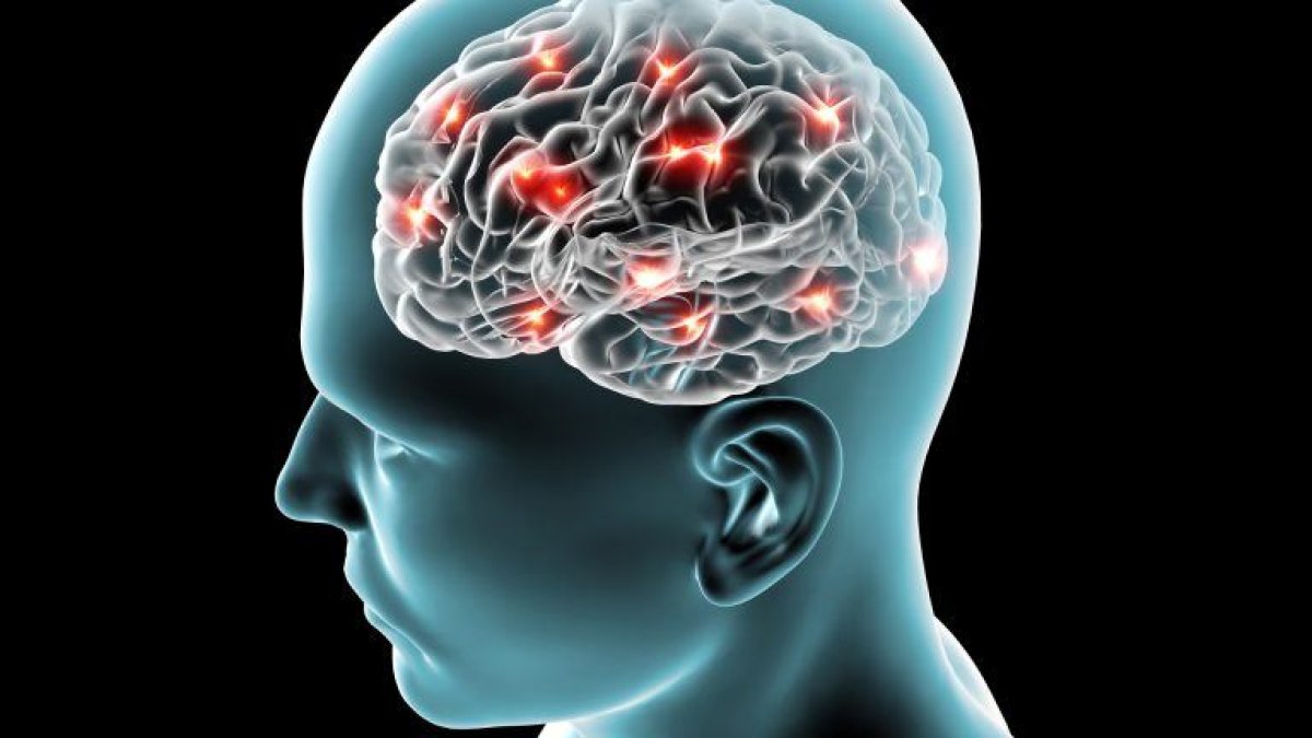 Referencial. La mayoría de los pacientes aquejados de una inflamación fueron diagnosticados de encefalomielitis aguda diseminada (ADEM).