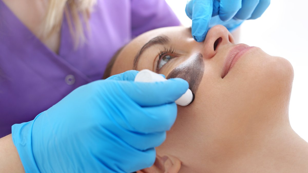 La mascarilla de carbón activado más láser Yang es el tratamiento favorito de las celebridades de Hollywood.