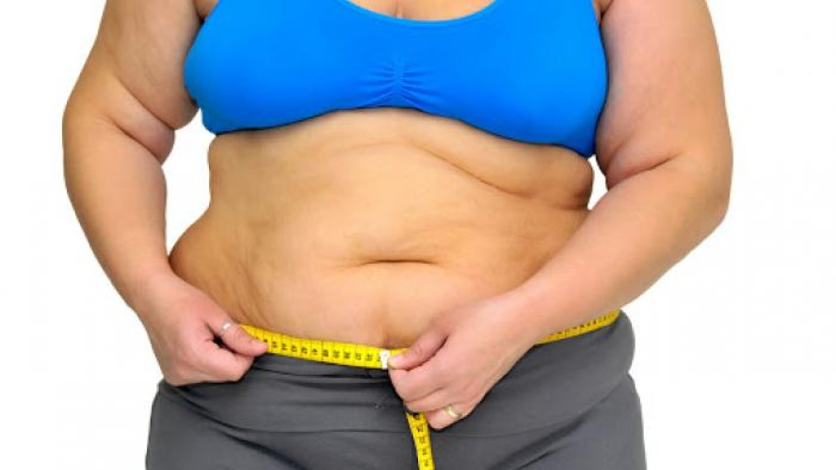 Las personas obesas, con diabetes e hipertensión, fueron los más propensos a necesitar ventilación mecánica.