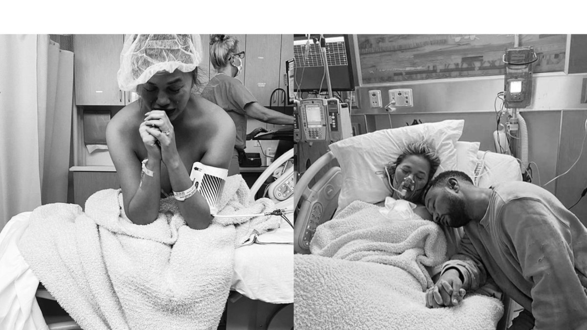 Chrissy Teigen ha documentado su hospitalización en redes sociales.