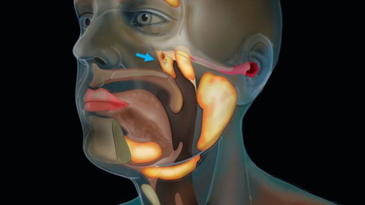 Para confirmar el descubrimiento, los expertos dicen que necesitarán expandir y diversificar su muestreo.