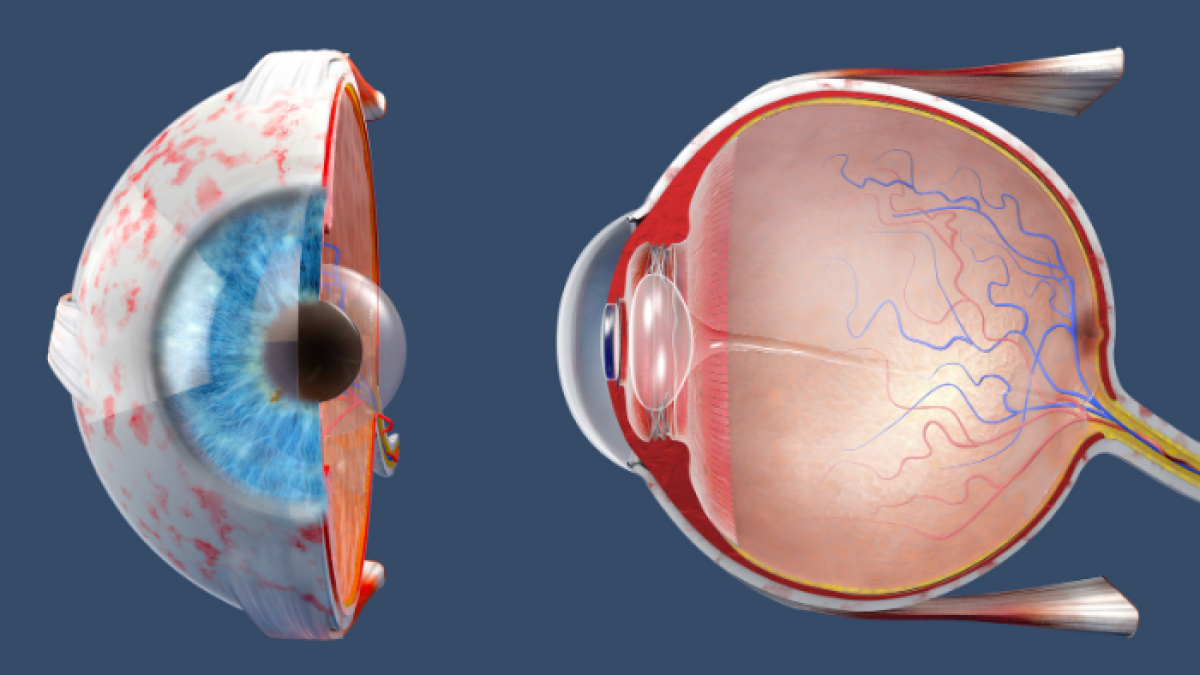 Los nuevos hallazgos, publicados en Cell Reports, sugieren que la córnea del ojo puede resistir la infección del nuevo coronavirus.