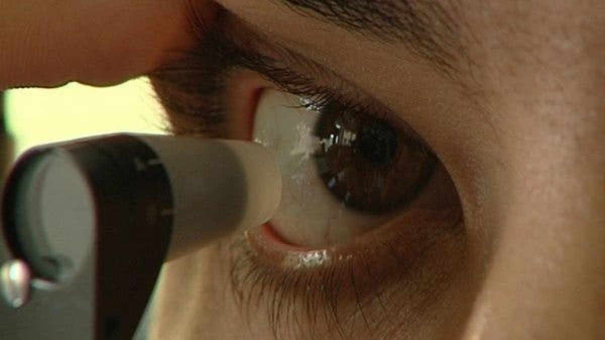 Clásicamente, la enfermedad solía presentarse a partir de los 60 años, pero actualmente se ve a todas las edades.