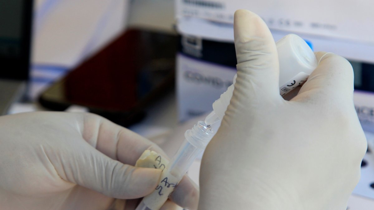 Turquía, un país de 80 millones de habitantes, registró hoy 254 muertes por covid-19, un número similar a la de los últimos días.