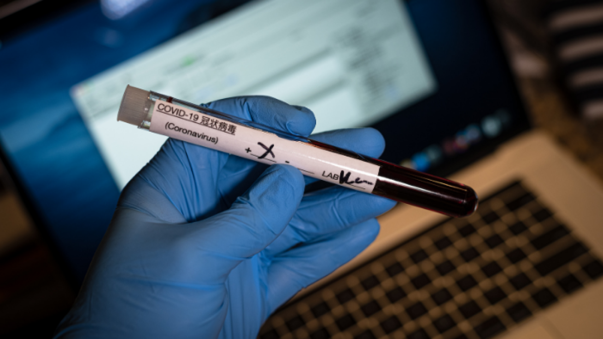 Según datos de la JHU, Estados Unidos sigue a la cabeza en el número de contagios en el mundo con 19'974.122.