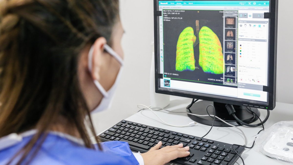 Una doctora del hospital Bicentenario de Guayaquil, que atiende a pacientes con coronavirus, analiza la imagen de unos pulmones.