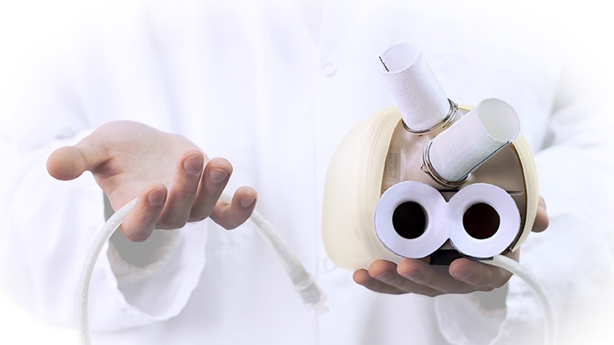 El corazón artificial de Carmat se dirige especialmente a personas en estado terminal en espera de un órgano vivo