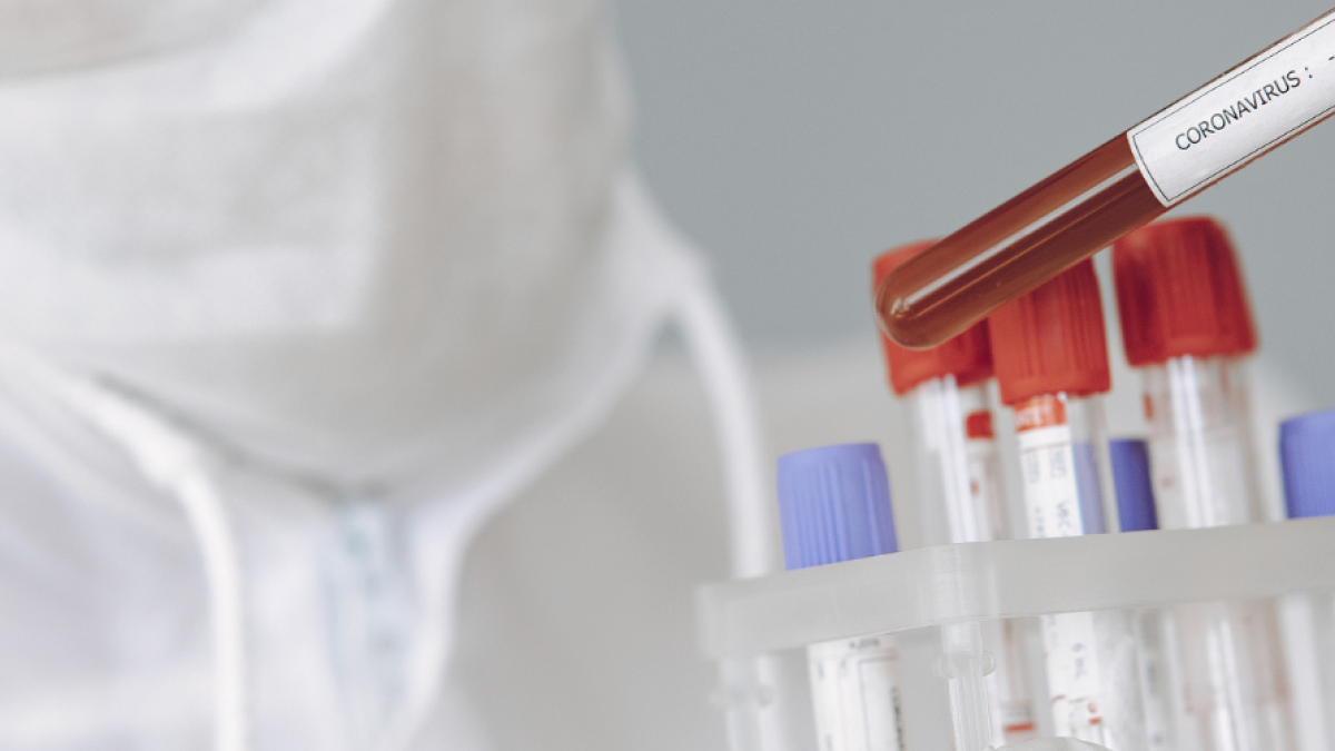 A Pichincha le sigue la provincia de Guaya con 31.846 casos, lo que representa un incremento de 154 nuevos positivos respecto a la víspera, cuando llegó a 31.686.