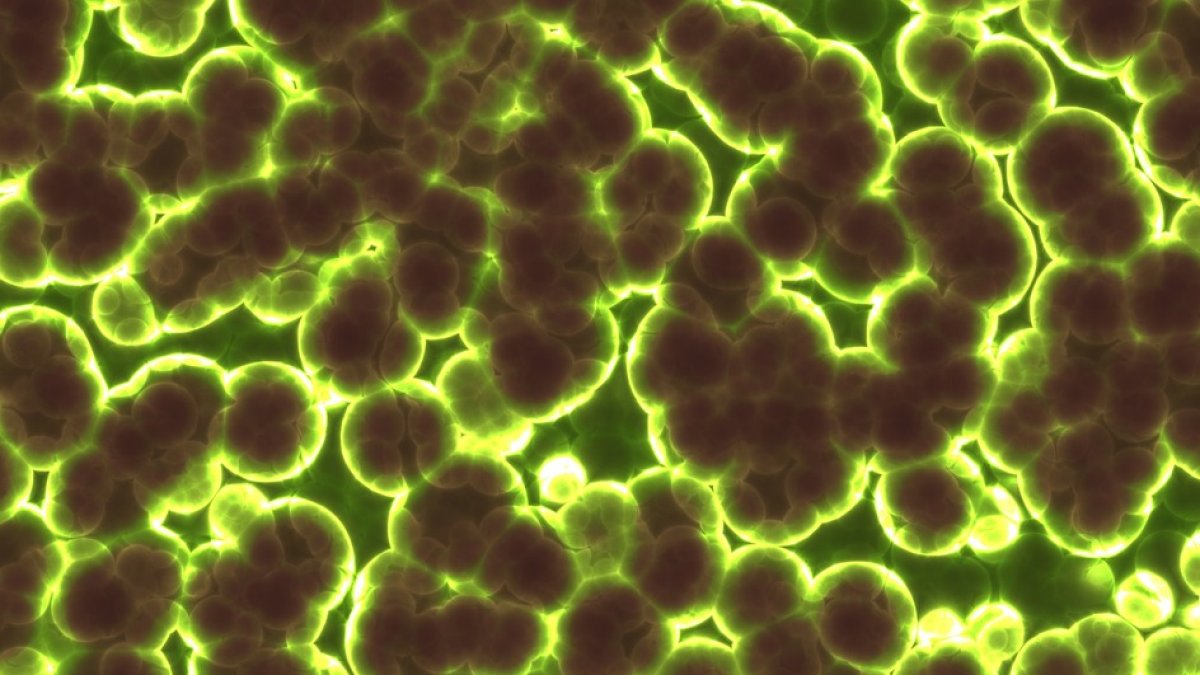 El hongo se disemina rápidamente en hospitales o centros médicos a través del contacto con superficies o equipos ambientales contaminados, o de persona a persona.