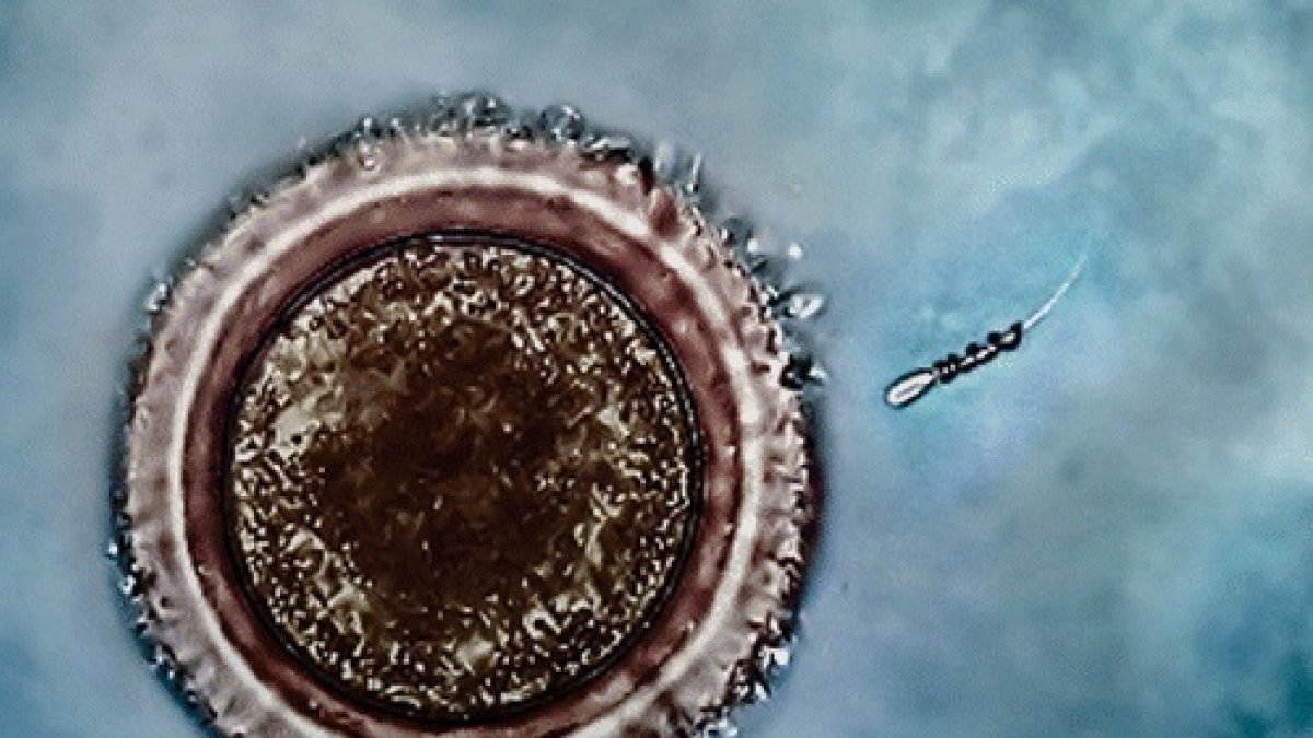 Los investigadores demostraron por primera vez de forma experimental que los espermatozoides con el haplotipo-t son más progresivos, es decir, avanzan más rápido que sus pares 