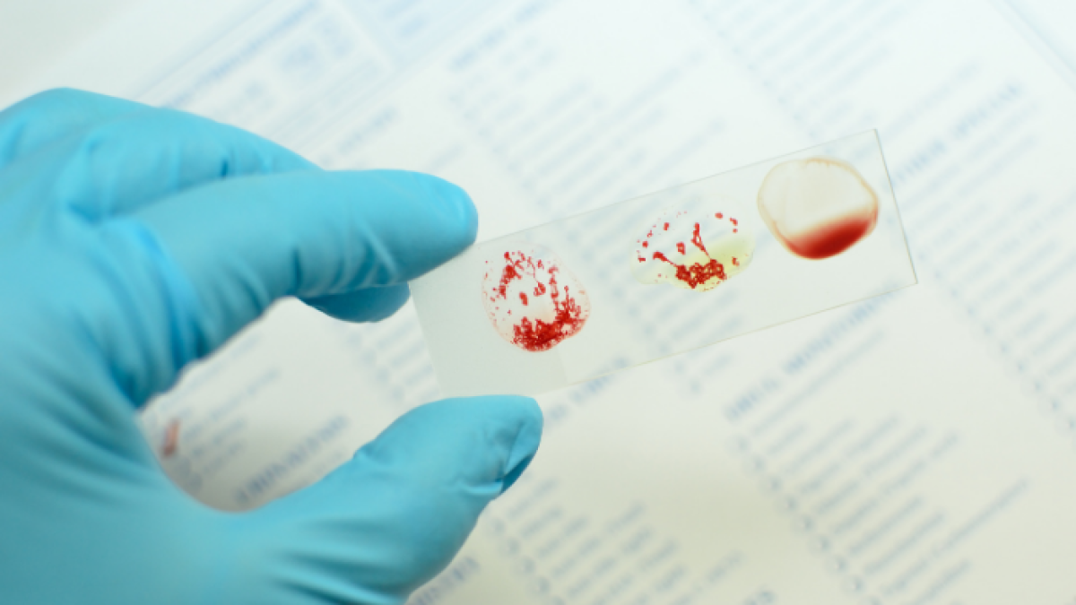 El RBD -que está dentro de la proteína Spike- es la parte del virus que se adhiere a las células huésped.