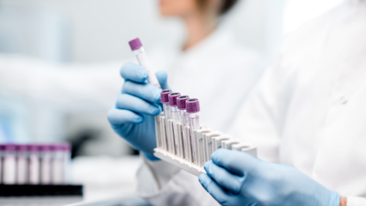 Referencial. La Organización Mundial de la Salud (OMS) señala que sólo se han administrado por ahora en el mundo unos 268 millones de dosis.