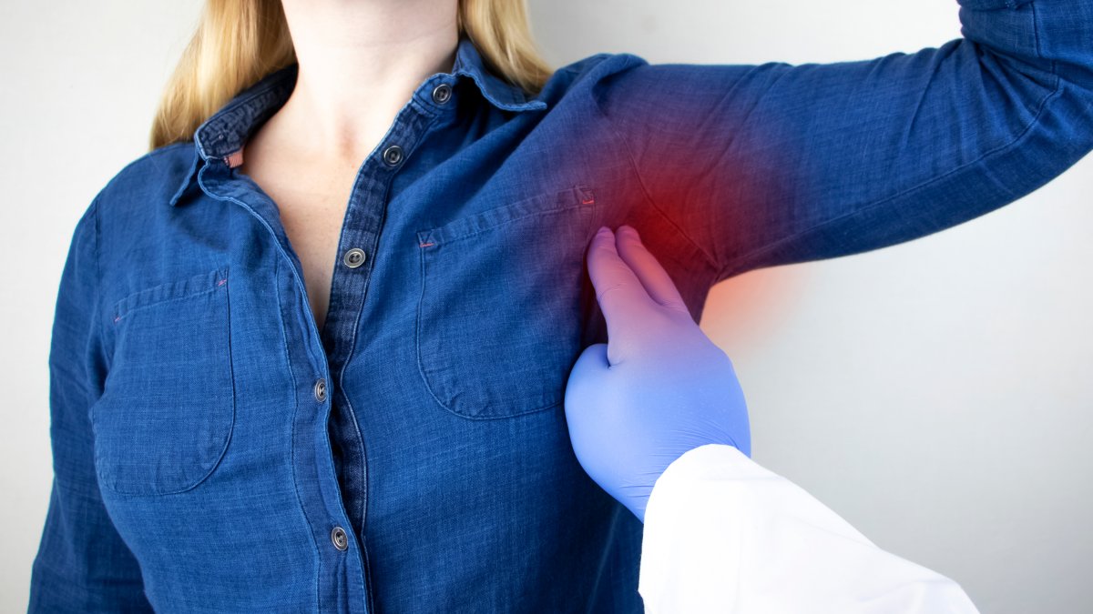 Los ganglios linfáticos