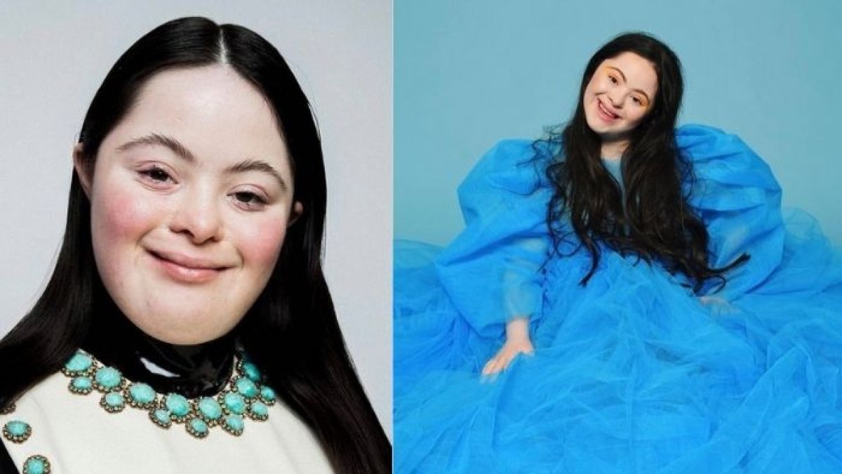 La modelo Ellie Goldstein tiene 19 años.