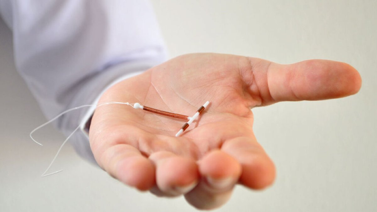 Los dispositivos intrauterinos son una opción como anticonceptivo.
