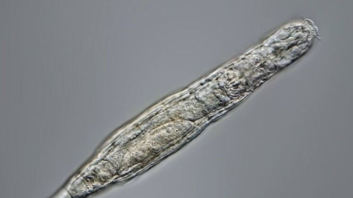 Ejemplar de rotífero.