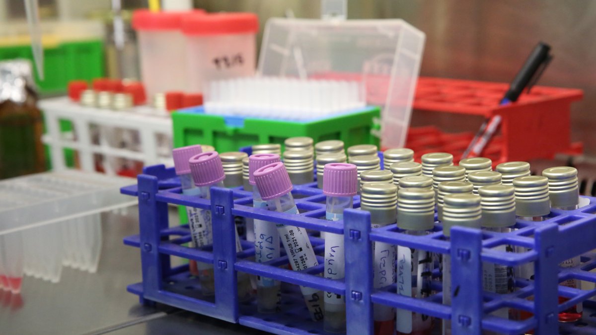 Científicos españoles han logrado identificar las moléculas que consiguen frenar la entrada del coronavirus en las células, un descubrimiento que podría abrir la puerta para desarrollar fármacos antivirales eficaces contra el SARS-CoV-2 responsable de la covid-19.