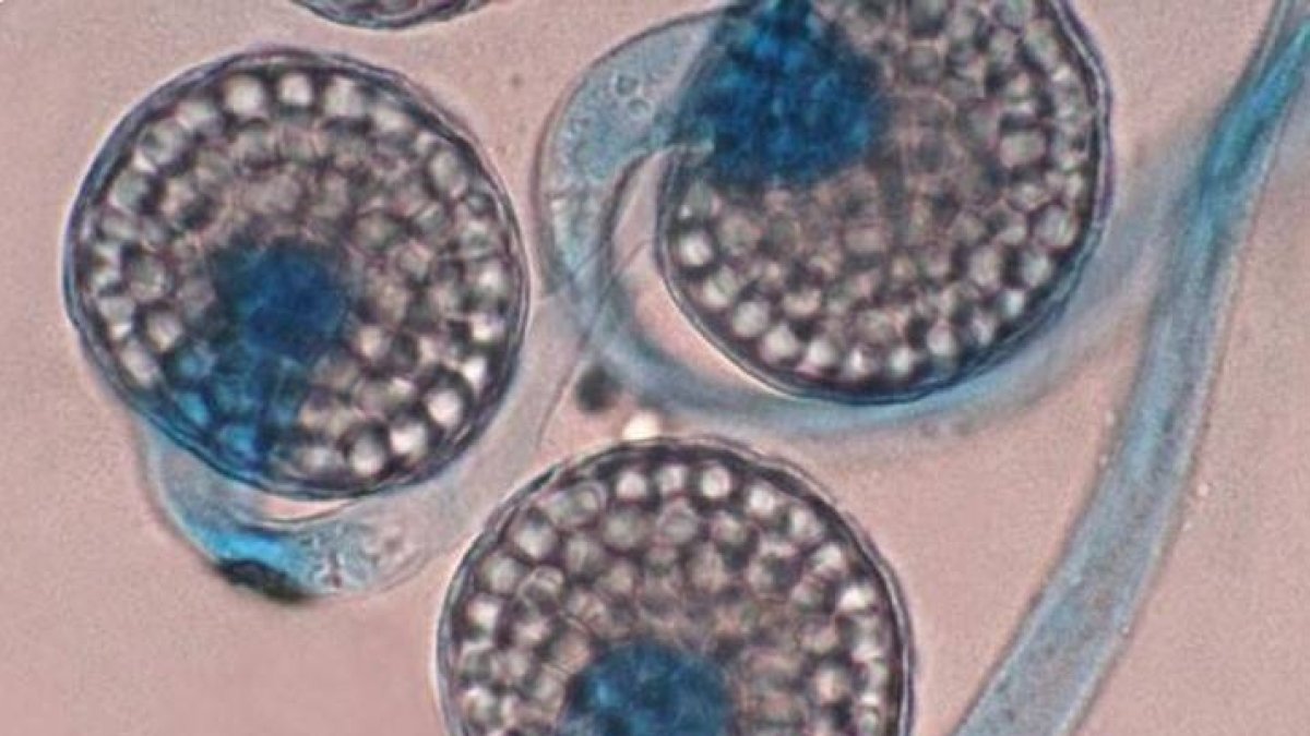 Imagen tomada a través de un microscopio que muestra un hongo Circinella lampensis.