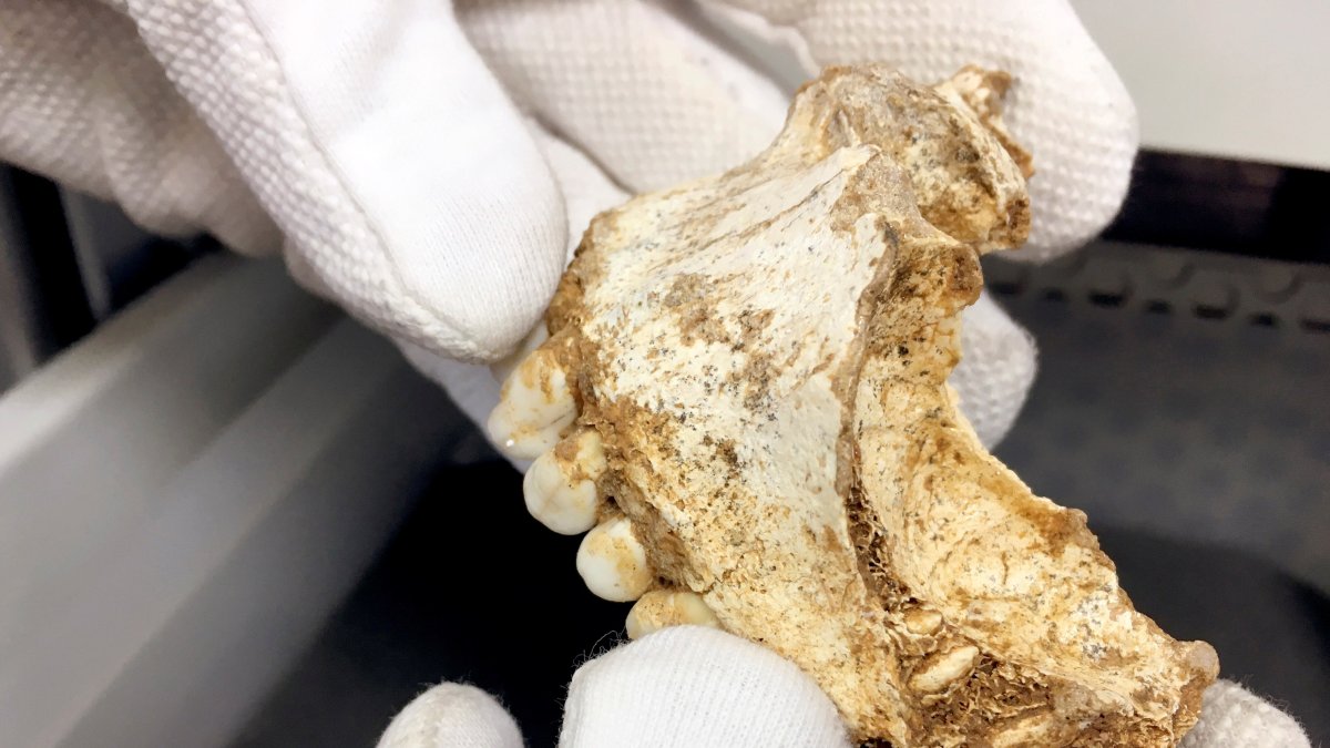 El 27 % de los jóvenes de 19 a 29 años ingresados con covid-19 desarrolla complicaciones, según un estudio realizado en el Reino Unido.