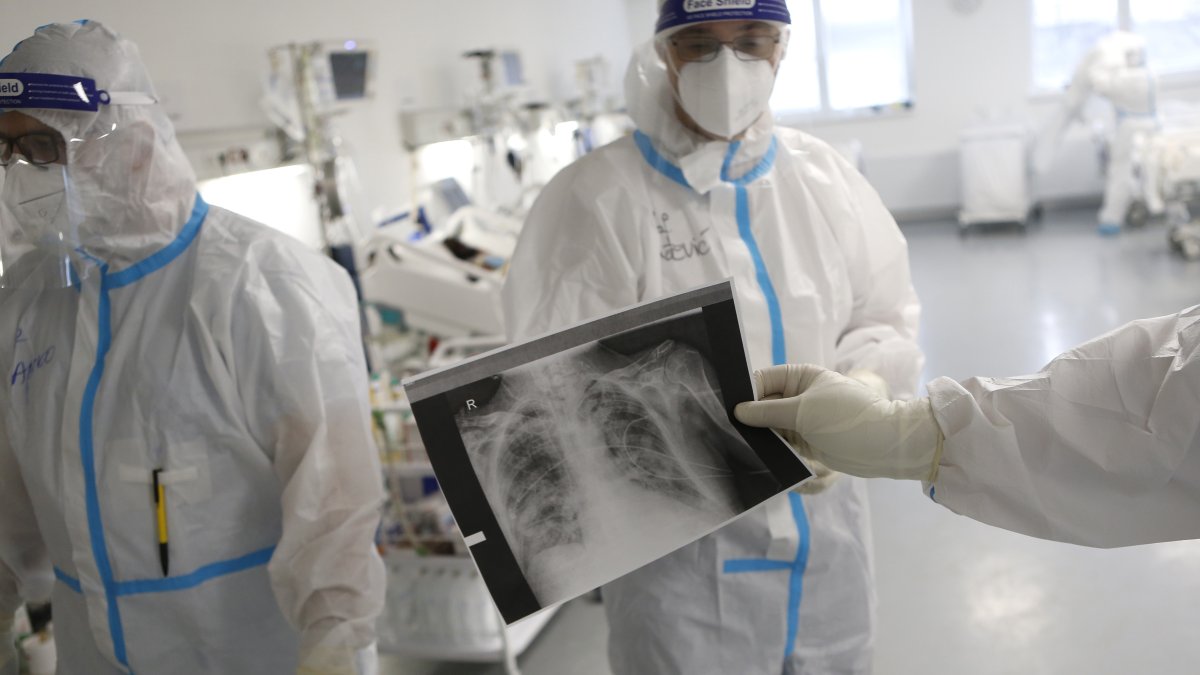 Hasta ahora, el coronavirus ha matado a más de 4 millones de personas en todo el mundo.