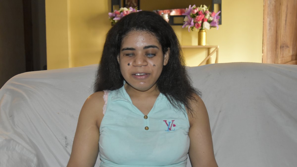 Angie Lozano tiene discapacidad visual de nacimiento.